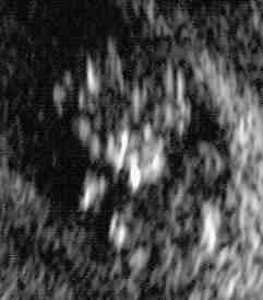 ultrasound1-crop